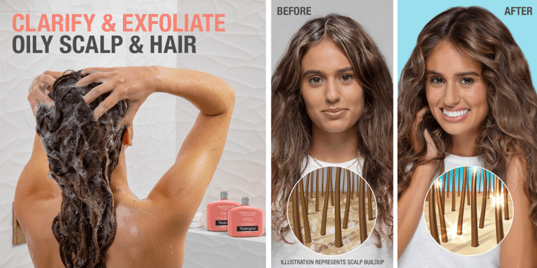 Show Your Scalp Some Love This Winter With This Hydrating Haircare Collection