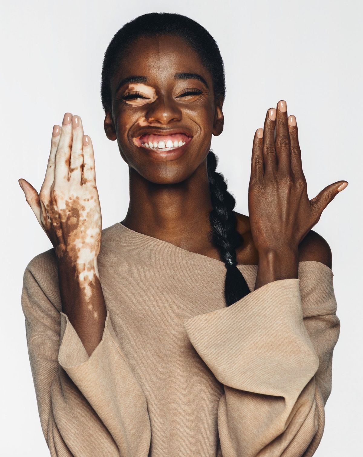 How Dermablend is Making Everyone Feel Comfortable in Their Own Skin