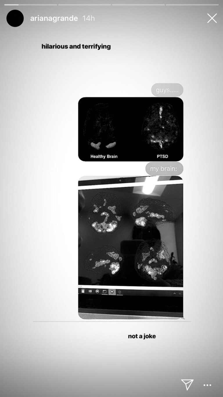 ariana grande brain scan