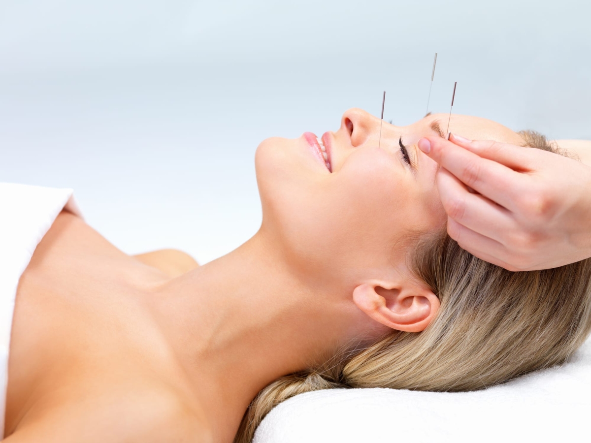 Why You Should Consider Cosmetic Acupuncture, The Other Kind of Needle For Your Face
