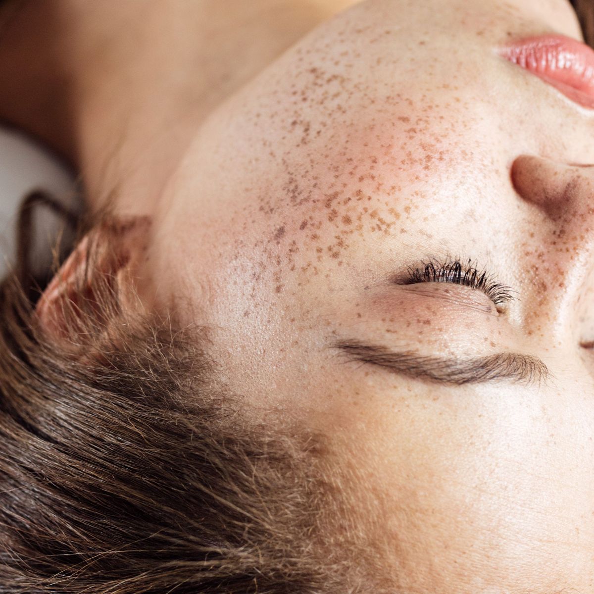 A Photo Exhibit About Skin Cancer Prevention Is A Call To Action That Honours Its Late Visionary