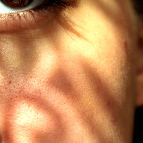 Can You Actually Shrink Your Pores?