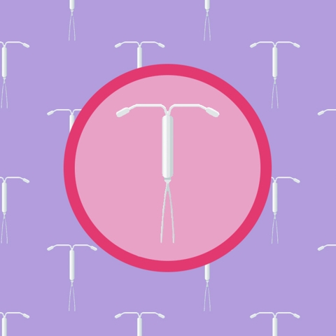 Should I Get an IUD?
