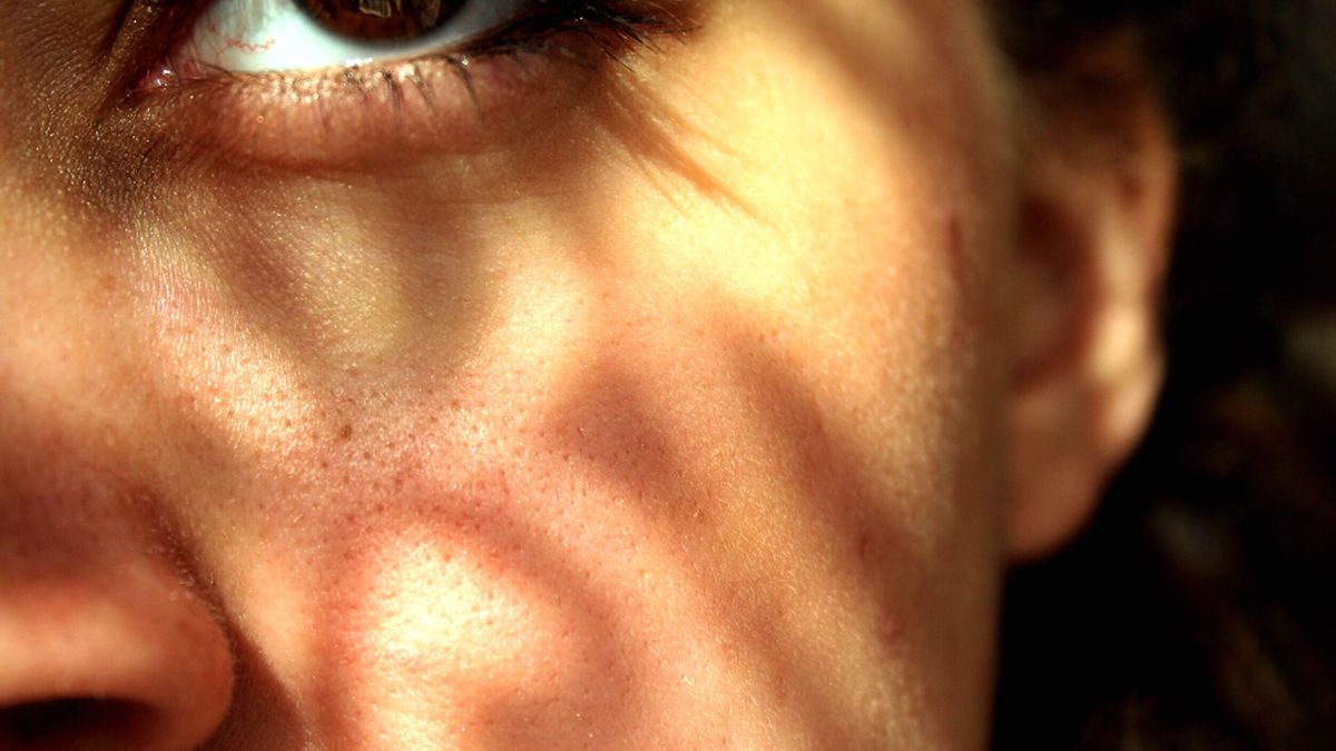 Can You Actually Shrink Your Pores?