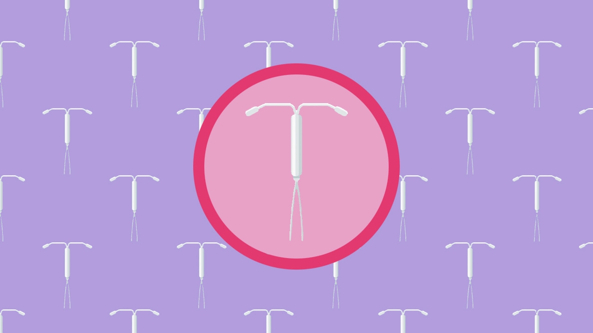 Should I Get an IUD?