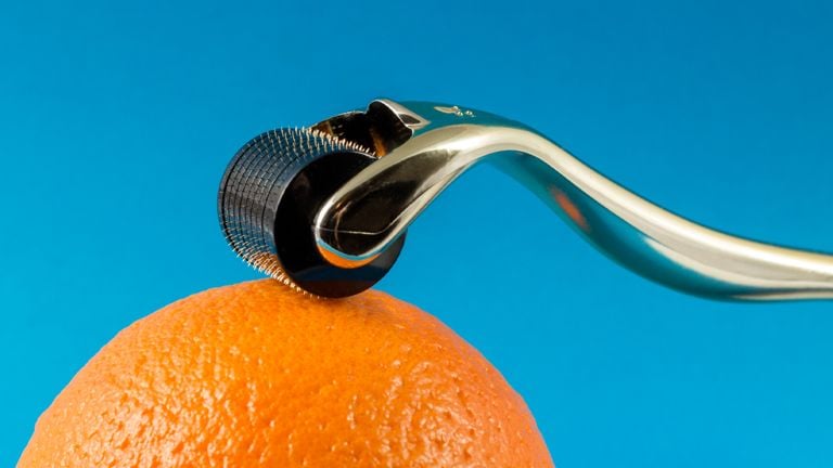 Dermarolling 101: What to Consider Before Microneedling At Home