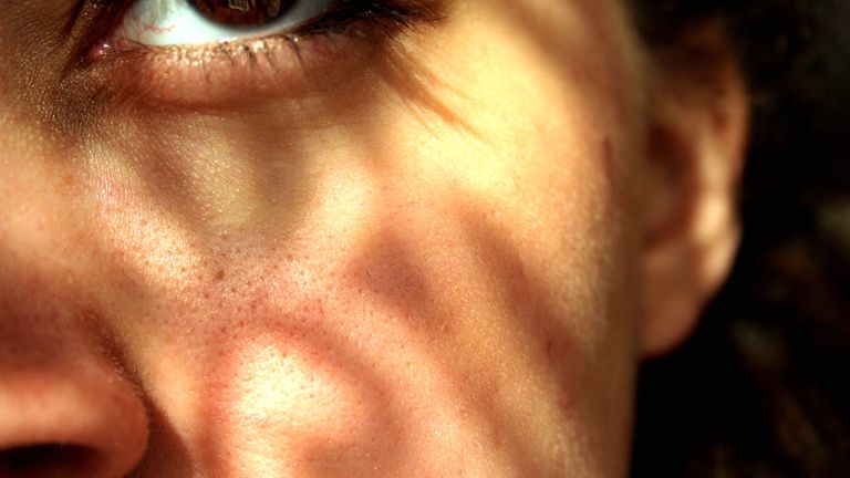Can You Actually Shrink Your Pores?
