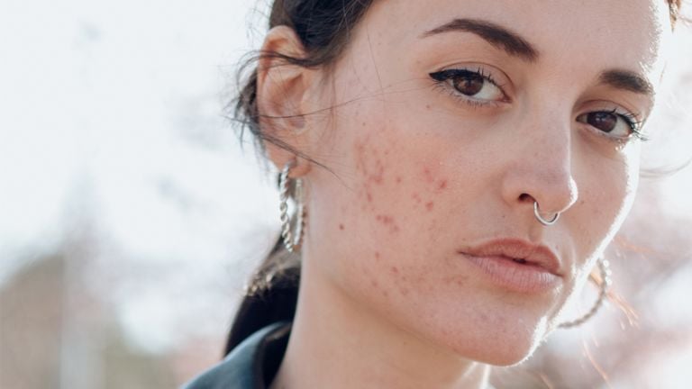 How to Deal with a Skin Allergy Outbreak Stat