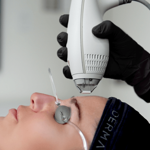 Fall Is the Best Time to Book Your Laser Treatment