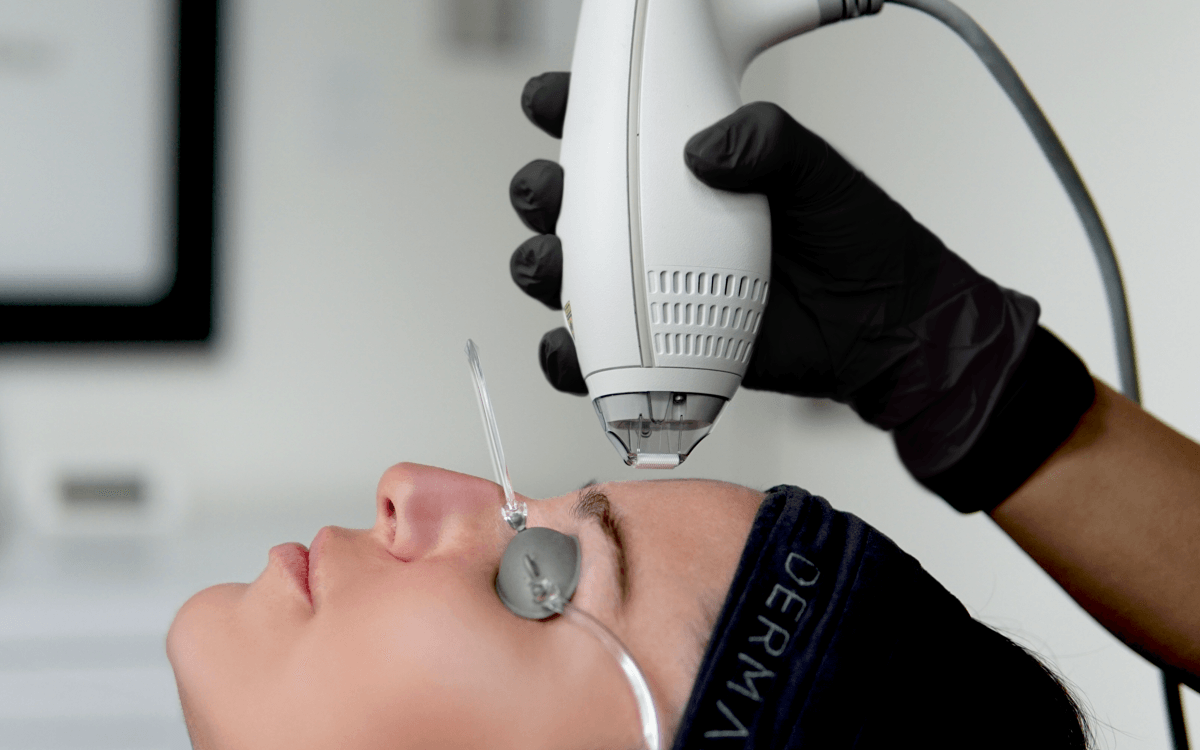 Fall Is the Best Time to Book Your Laser Treatment