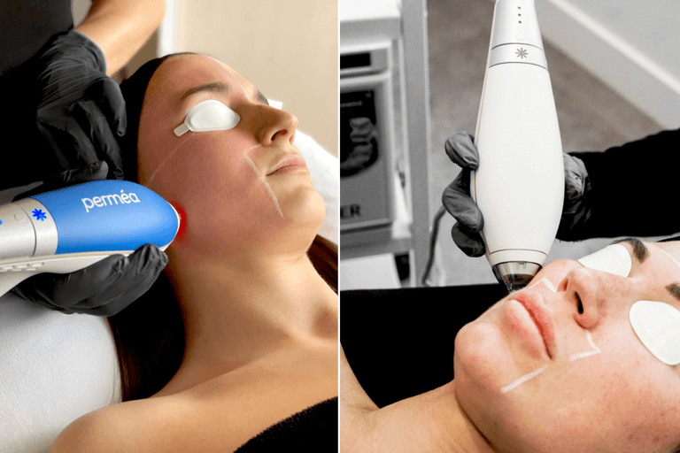 Fall Is the Best Time to Book Your Laser Treatment