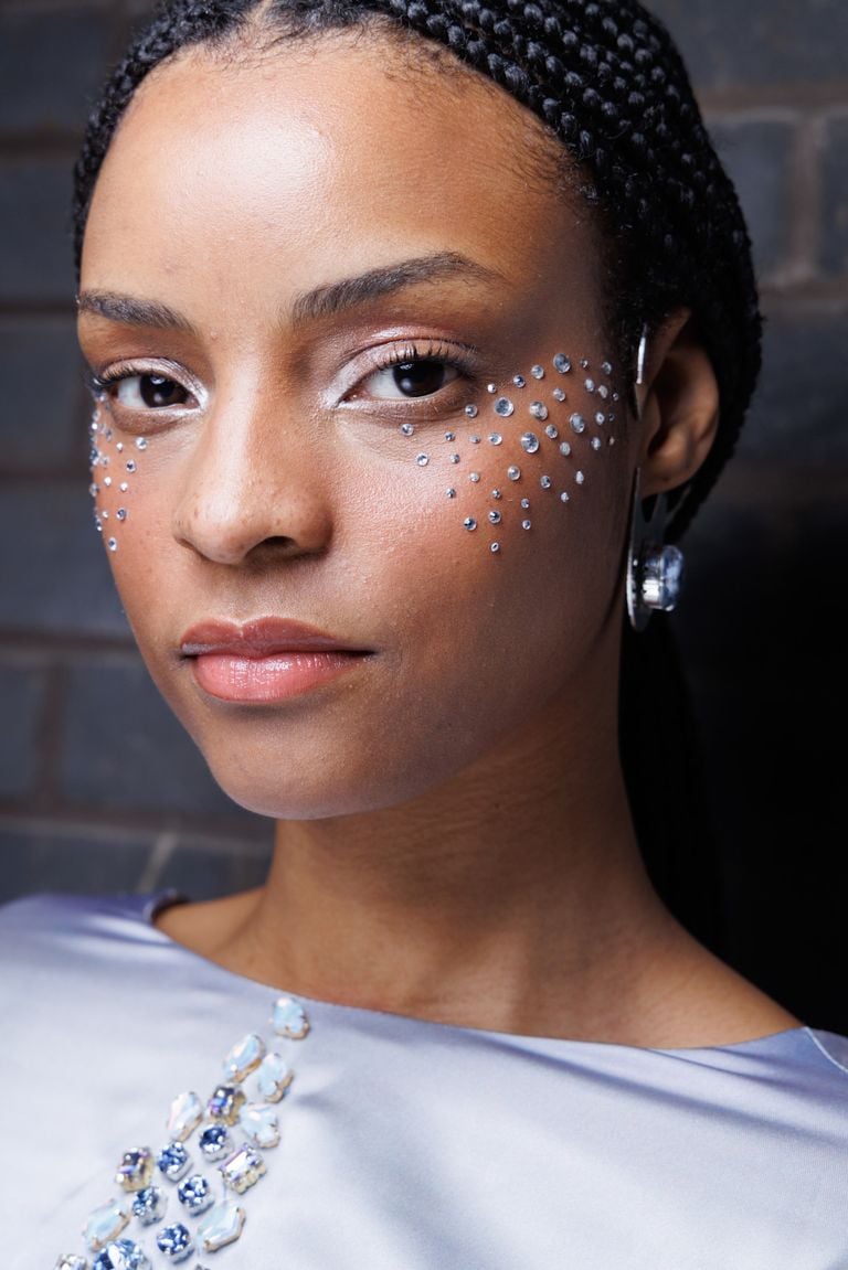 adult acne