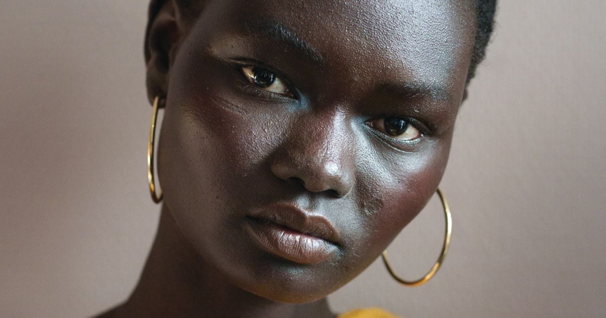 Scar Removal 101: Treatments for Every Kind of Scar - FASHION Magazine