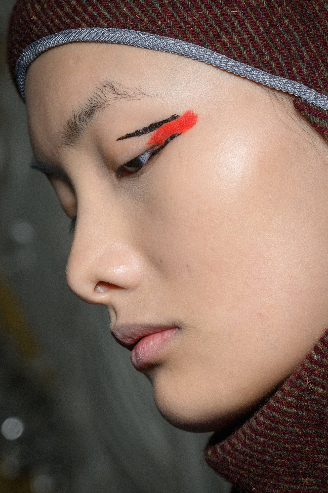 dark lips, lip hyperpigmentation